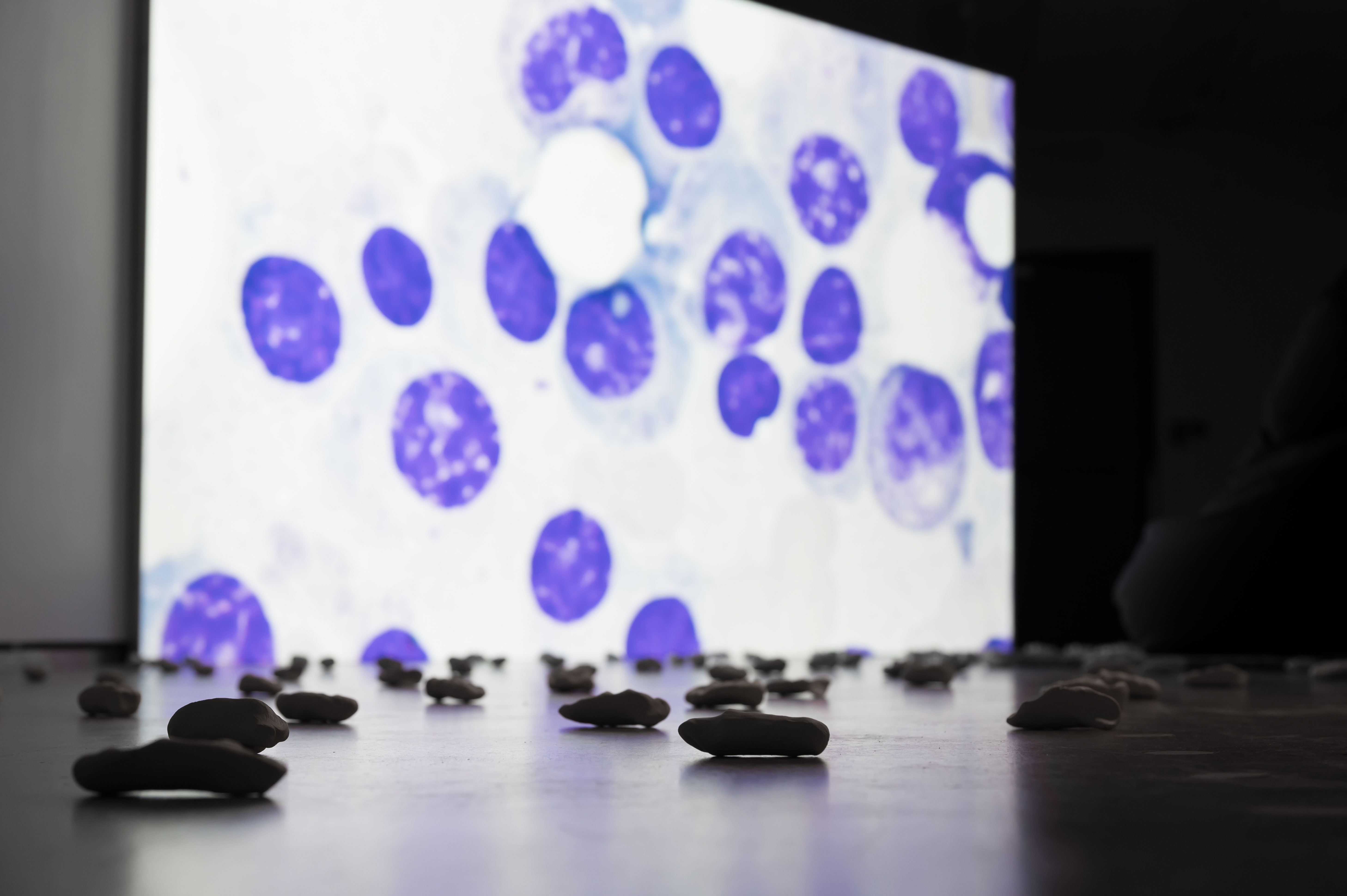 The Murmur of the Dying